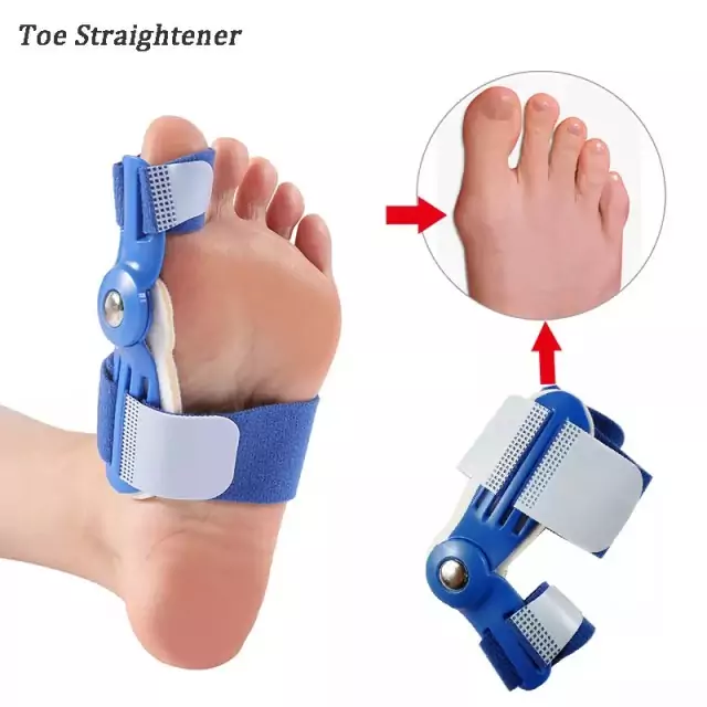 Hallux valgus įtvaras